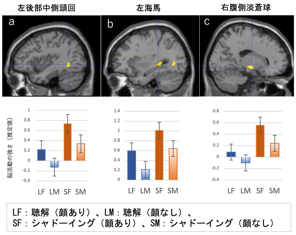 図2. 顔が見える条件で増加した脳活動（統合・記憶・動機づけ関連領域）