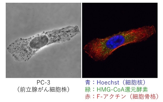 前立腺がん細胞株